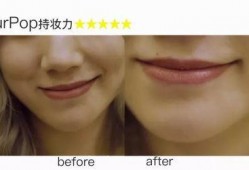 洋瓜尖耳洞化脓可以吃吗,洋瓜尖耳洞化脓期间的饮食注意事项