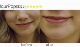 洋瓜尖耳洞化脓可以吃吗,洋瓜尖耳洞化脓期间的饮食注意事项