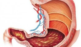 胃癌可以吃籽瓜吗,营养与健康的双重守护